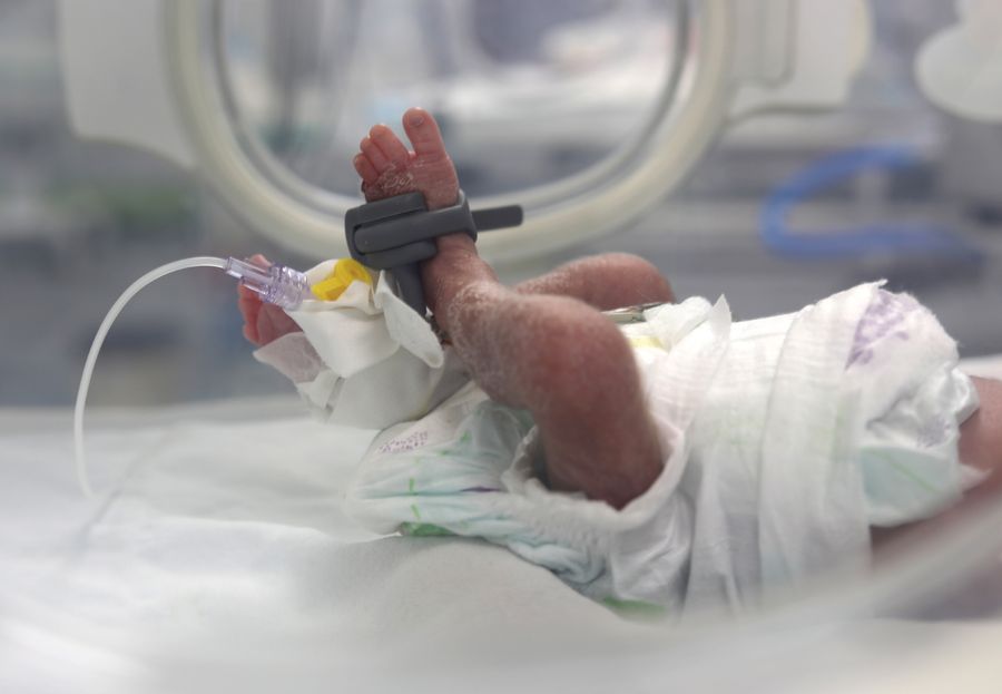 Three babies under a month old arrive dead at Nasser Hospital